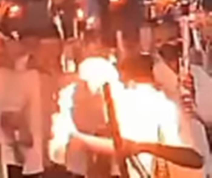 Pawai Obor 1 Muharam di Purwakarta Diwarnai Insiden Sembur Api, Korban Alami Luka Bakar di Wajah